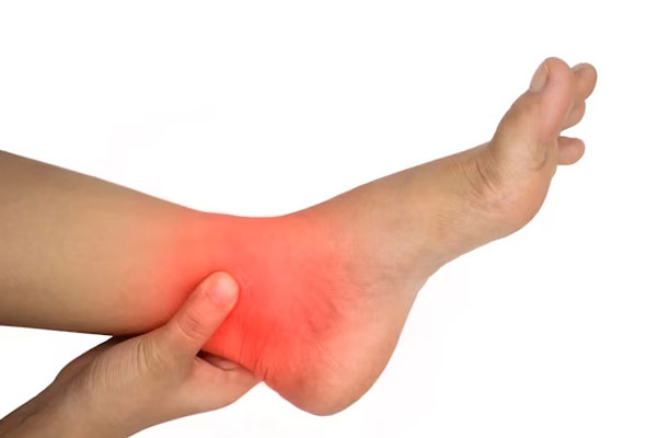 Achilles Tendonitis in Gilbert, Scottsdale, Chandler, Mesa & Phoenix, AZ