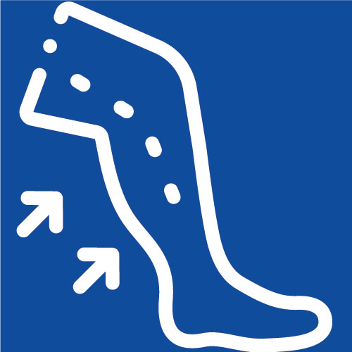 Flatfeet