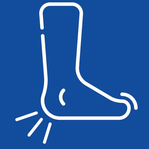 Rheumatoid Arthritis