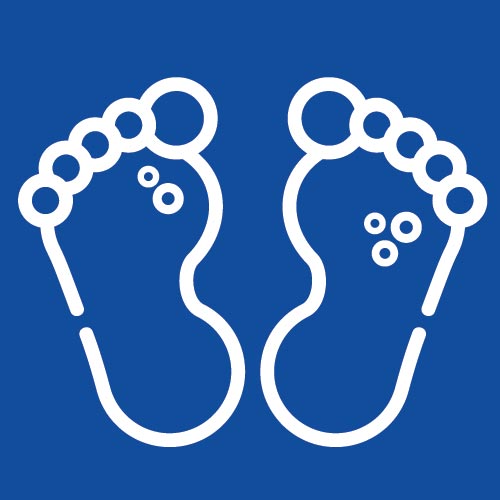 Plantar Warts