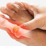 Foot Gout Treatment in Arizona
