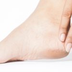 Caring for Cracked Skin on Your Diabetic Feet