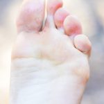 Does Lysol Kill an Athlete's Foot