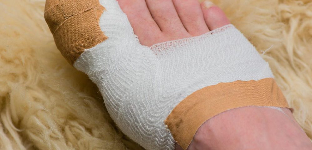 How Long to Keep Bandage on After Ingrown Toenail Removal