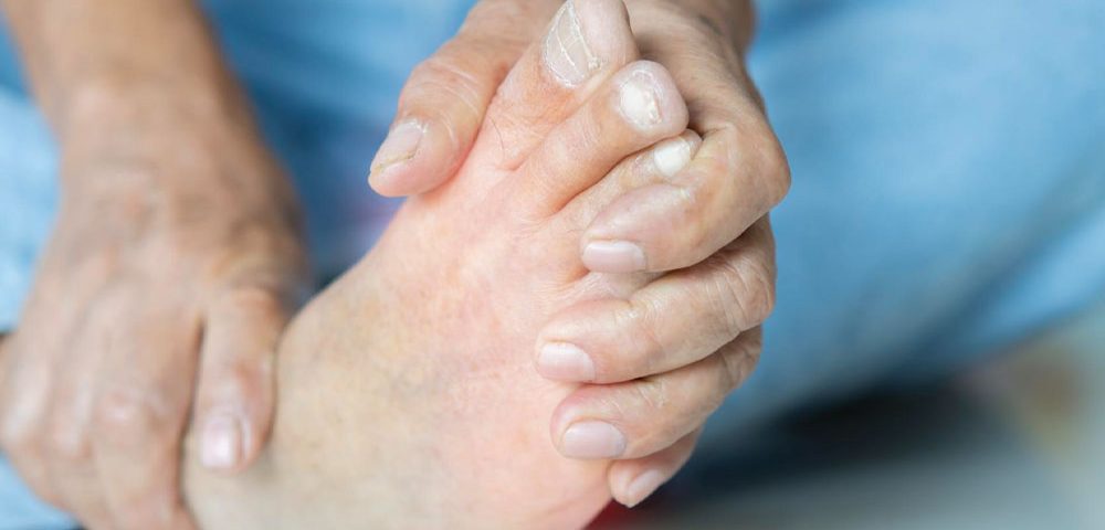 What Are Some Treatments for Rheumatoid Arthritis