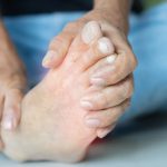 What Are Some Treatments for Rheumatoid Arthritis