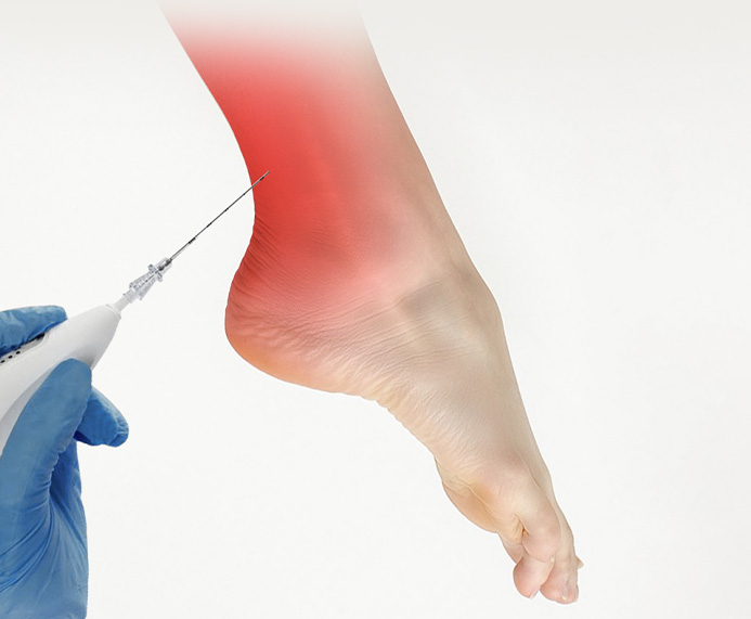 Tendon Mobile Popup
