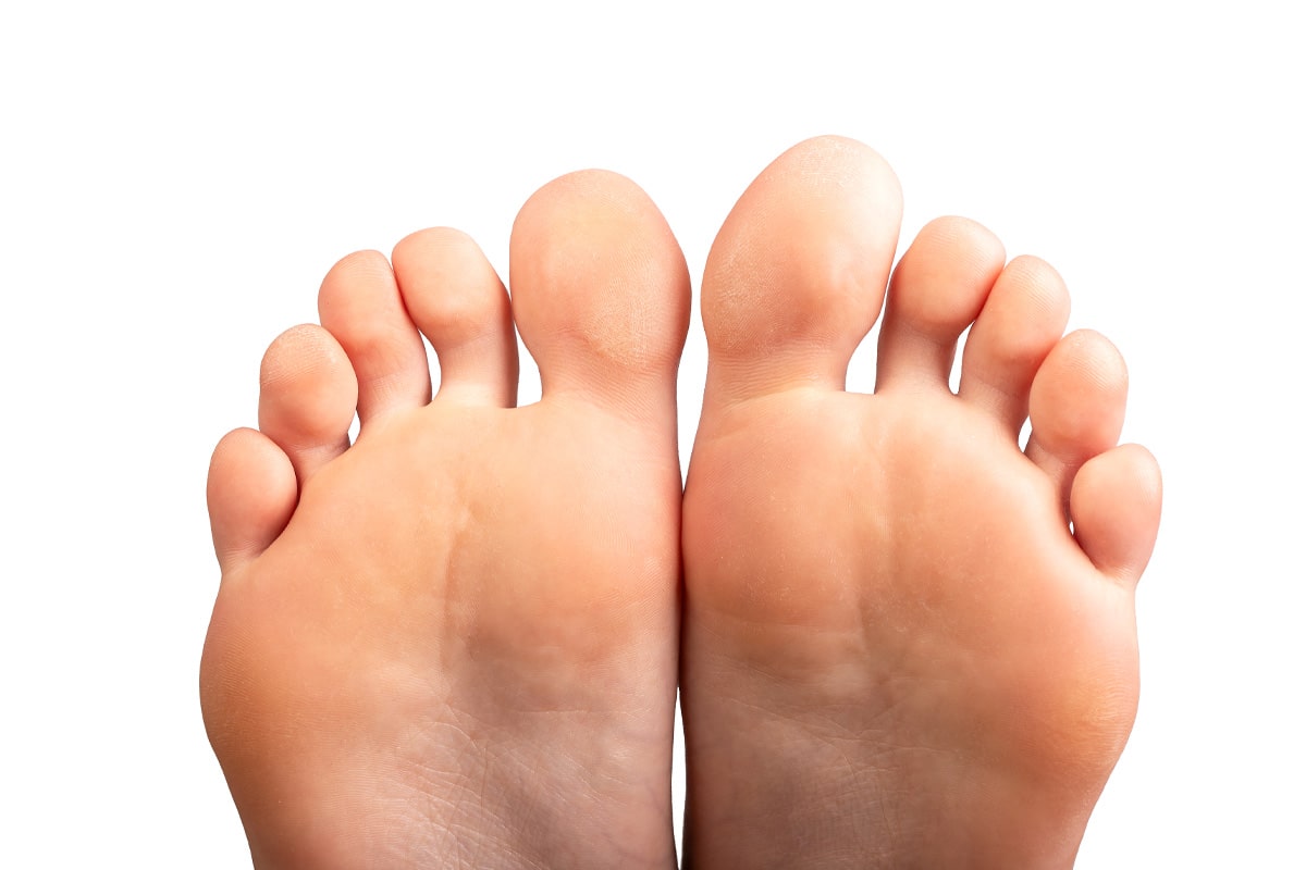 Diabetic Foot Gallery - After