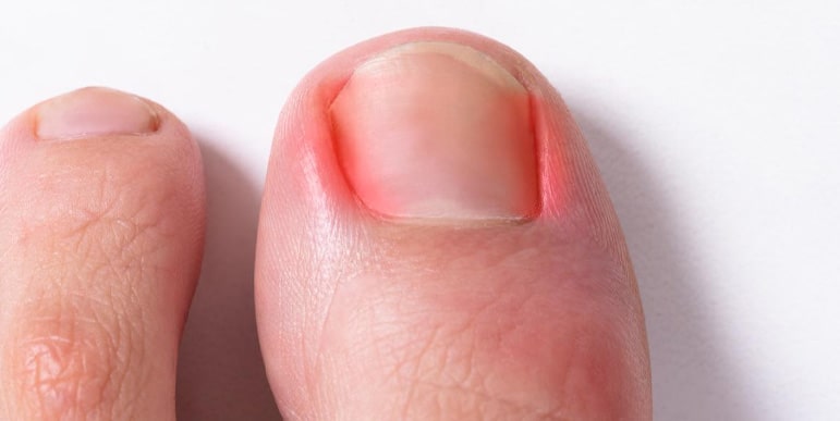 Preventive Care and Expert Advice