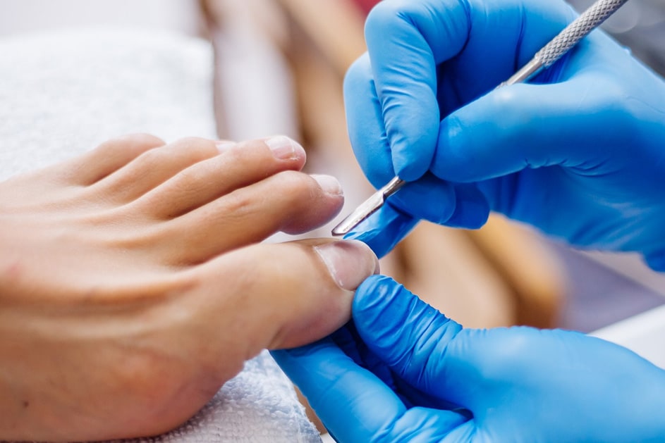 Why Choose Our Ingrown Toenail Clinics?