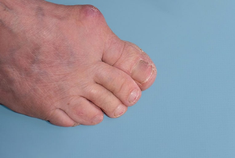 Pain Relief