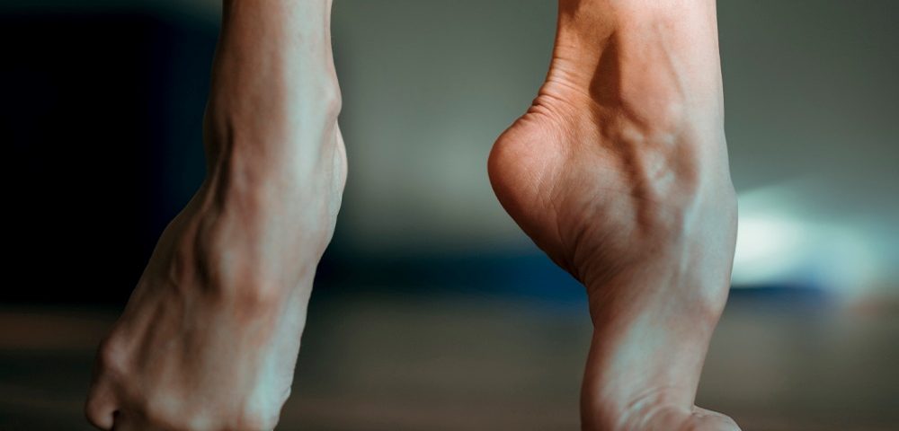 Is Hammertoe Hereditary?