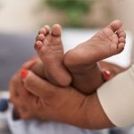 What Are Clubfoot Baby Foot Problems?