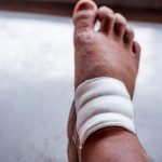 Hammer Toe and Diabetes: What’s the Link?