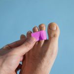 How to Fix Hammer Toes with Tape?