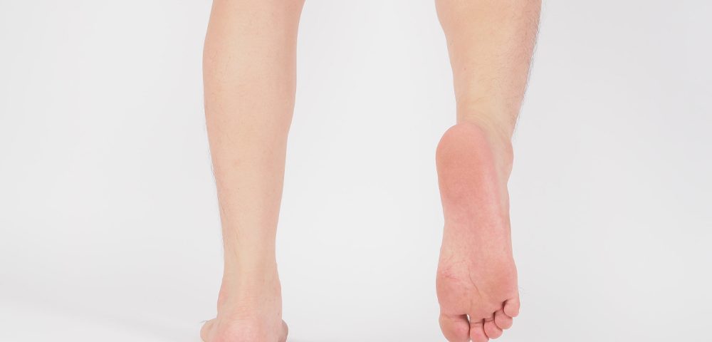 Running with Flat Feet: Is It Possible?