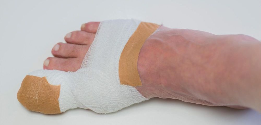 5 Signs of Infection After Toenail Removal Surgery