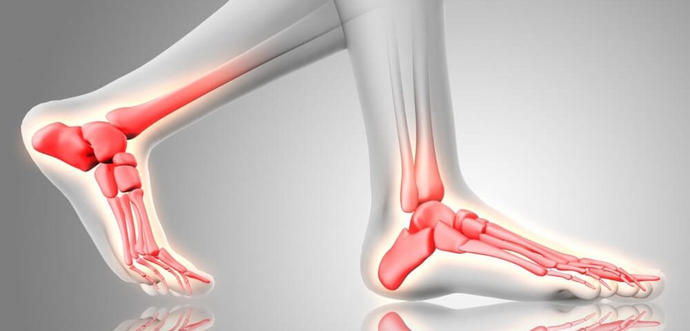 What Are the Causes of Heel Pain in the Morning?