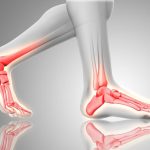 What Are the Causes of Heel Pain in the Morning?