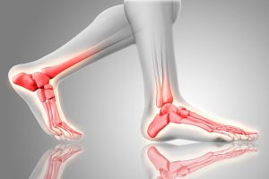 What Are the Causes of Heel Pain in the Morning?