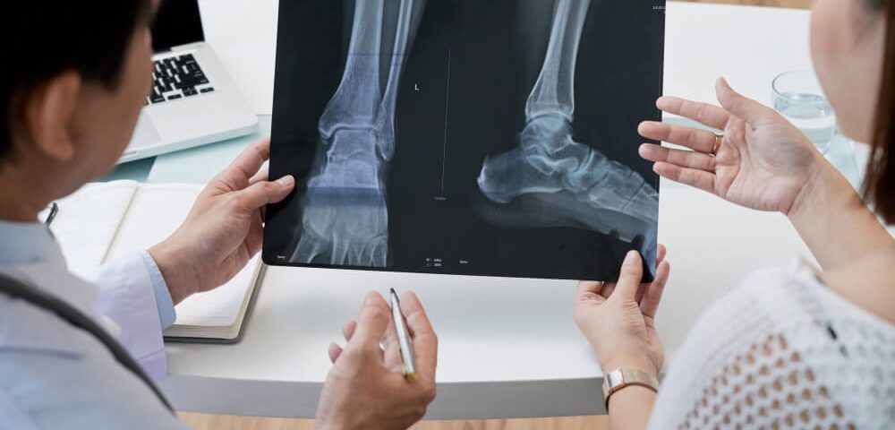 What Are the Different Types of Bunion Surgery?