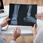 What Are the Different Types of Bunion Surgery?