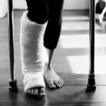 Broken Foot Surgery Cost in Phoenix, AZ