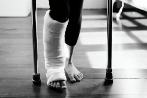 Broken Foot Surgery Cost in Phoenix, AZ