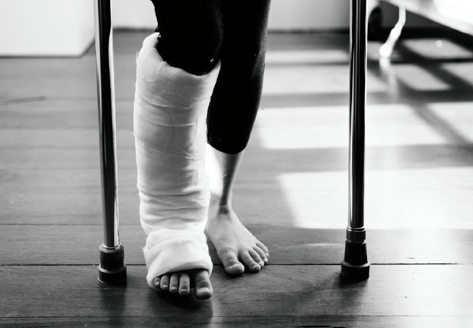 Broken Foot Surgery Cost in Phoenix, AZ