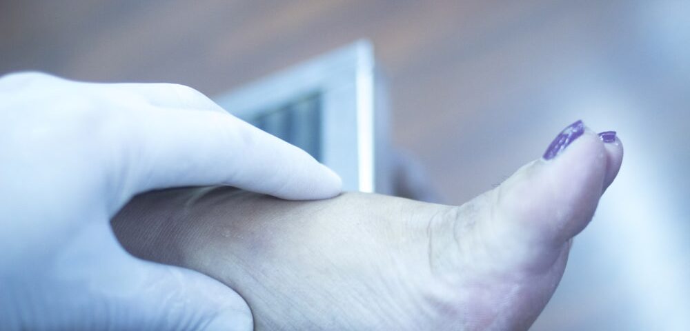 How Much Does the Treatment of Gout in the Foot Cost in Phoenix, AZ?