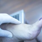 How Much Does the Treatment of Gout in the Foot Cost in Phoenix, AZ?