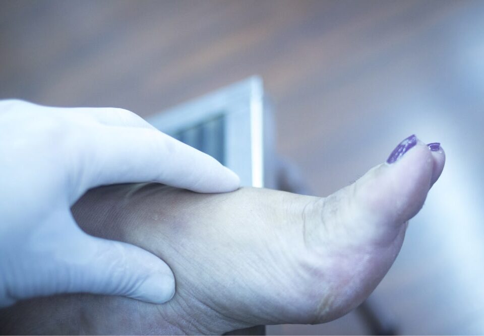 How Much Does the Treatment of Gout in the Foot Cost in Phoenix, AZ?
