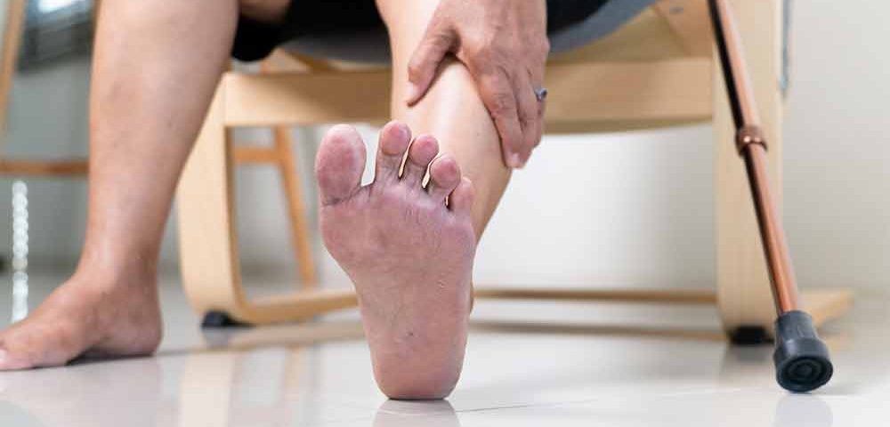 10 Common Foot Problems in the Elderly