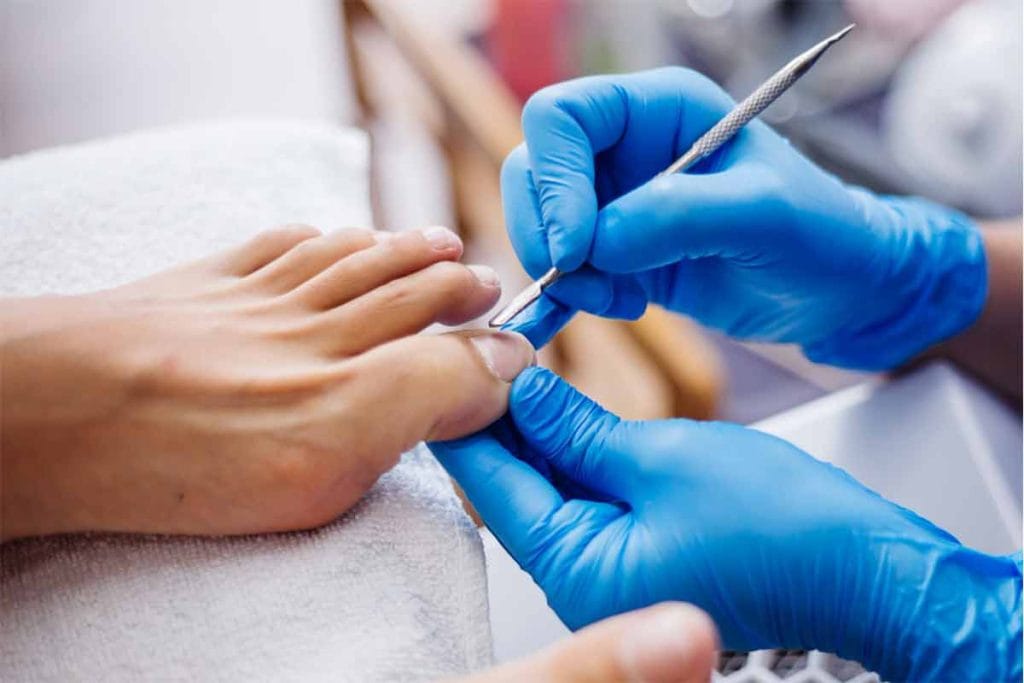 How to Tell If It's an Ingrown Toenail