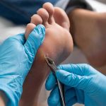 Podiatrist Accepting New Patients