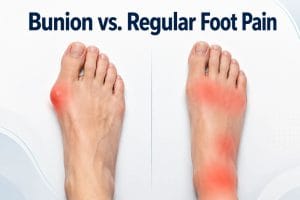 Bunion vs. Regular Foot Pain