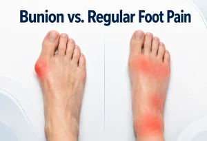 Bunion vs. Regular Foot Pain