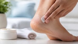 heal a cracked heel