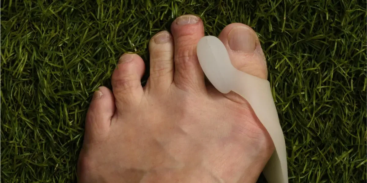 Bunion Treatments in Mesa